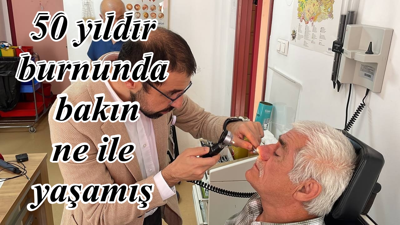 50 yıldır burnunda bakın ne ile yaşamış